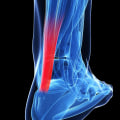 Understanding Tendonitis: Types, Causes, and Legal Options