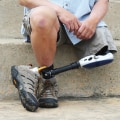 How to Effectively Follow-Up After a Personal Injury