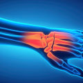 Understanding Repetitive Strain Injuries
