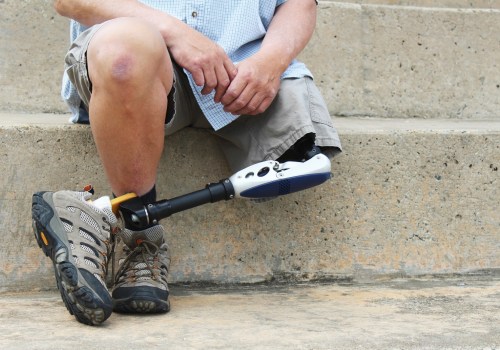 How to Effectively Follow-Up After a Personal Injury