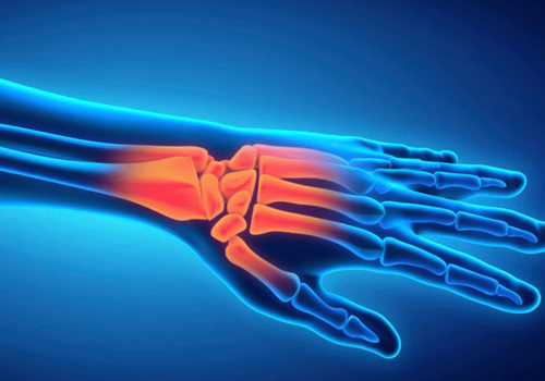 Understanding Repetitive Strain Injuries